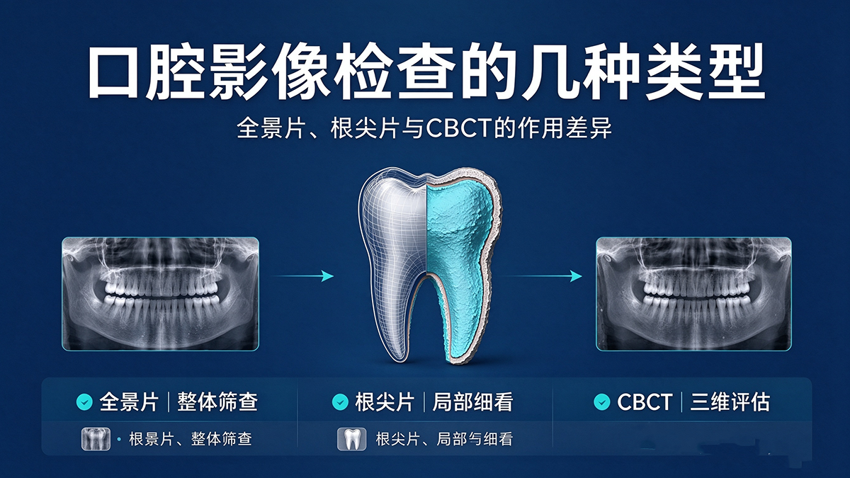 口腔影像检查的几种类型：全景片、根尖片与CBCT的作用差异
