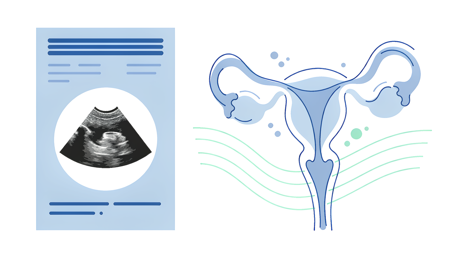 体检发现盆腔积液、宫颈纳囊要紧吗？常德女性报告解读