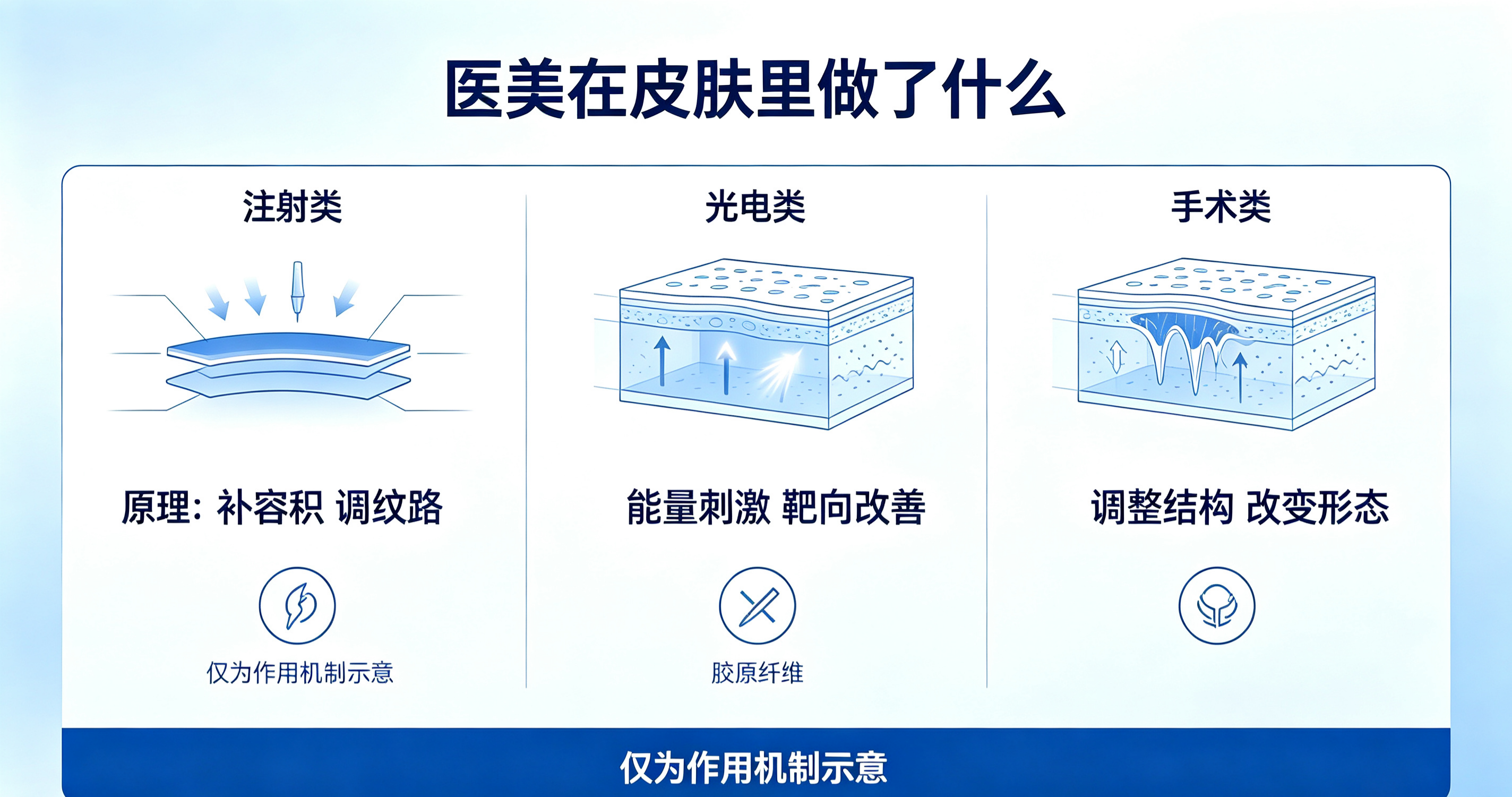 医美项目到底在皮肤里做了什么：注射、光电、手术三大类的作用原理
