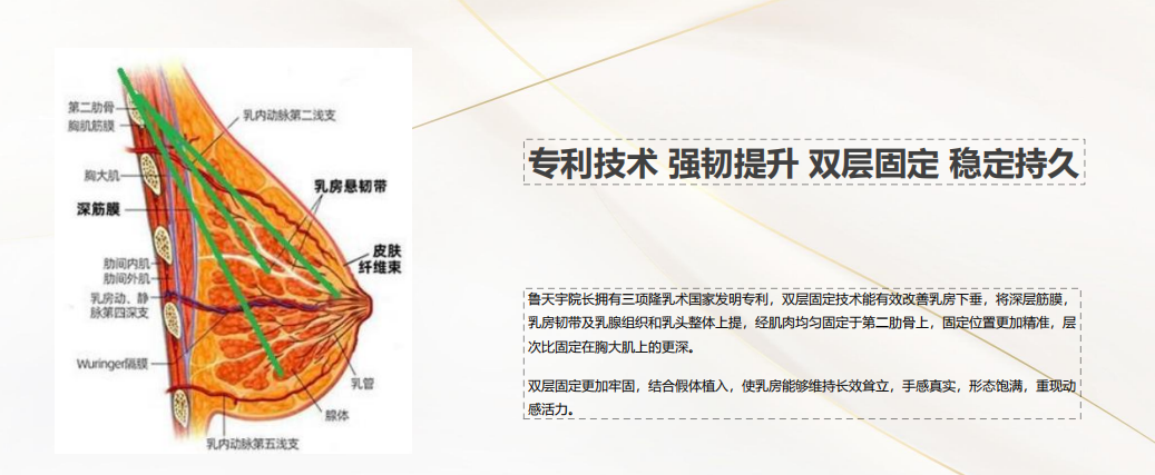 2026贵州形体雕塑新趋势：隆胸与吸脂联合塑形权威机构解析