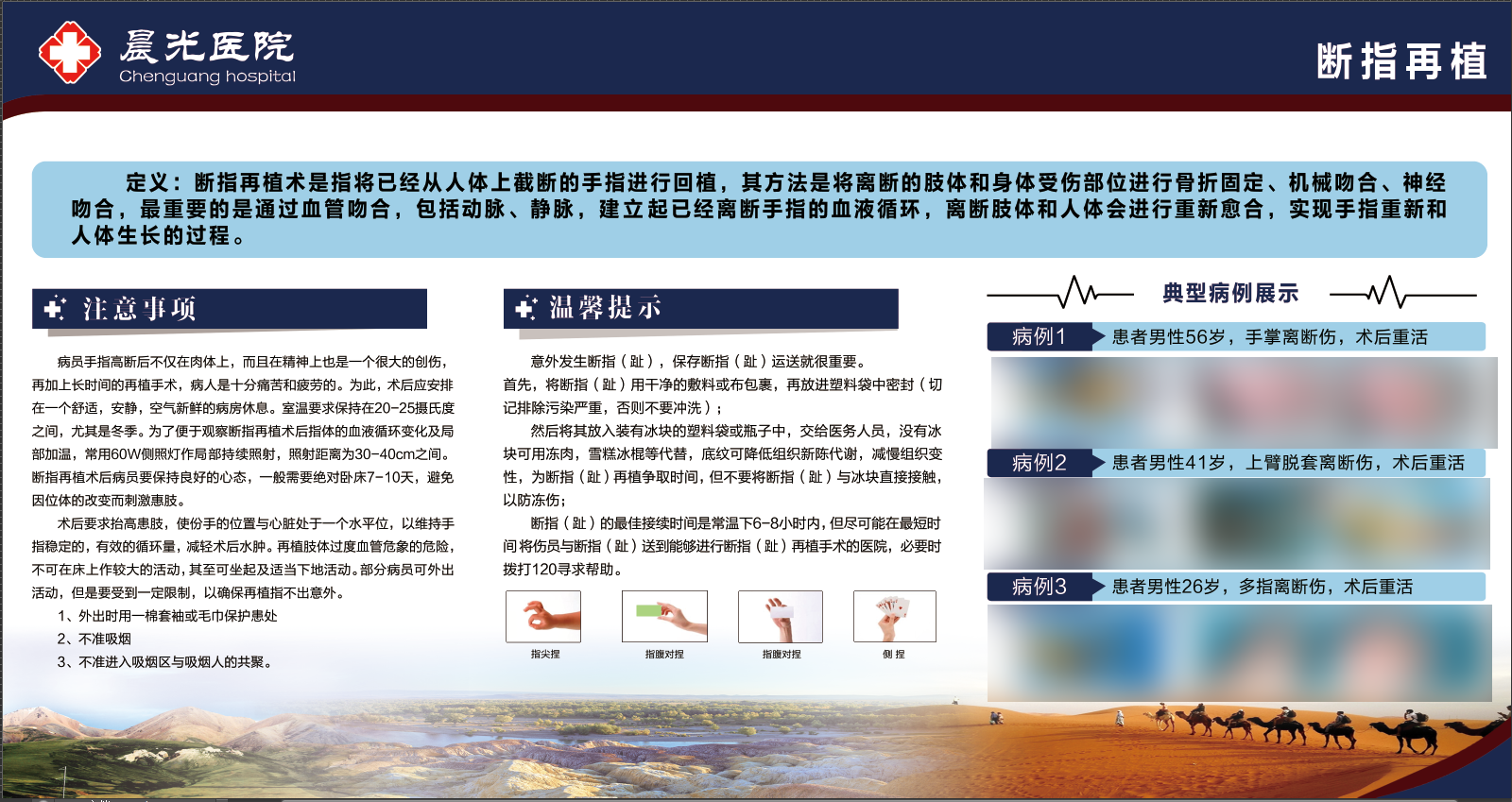 断指再植 —— 显微缝合