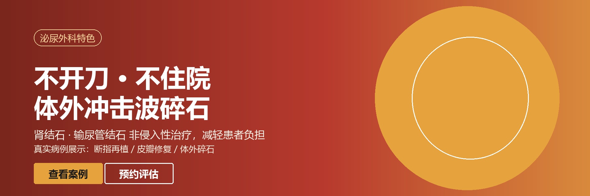 泌尿外科特色