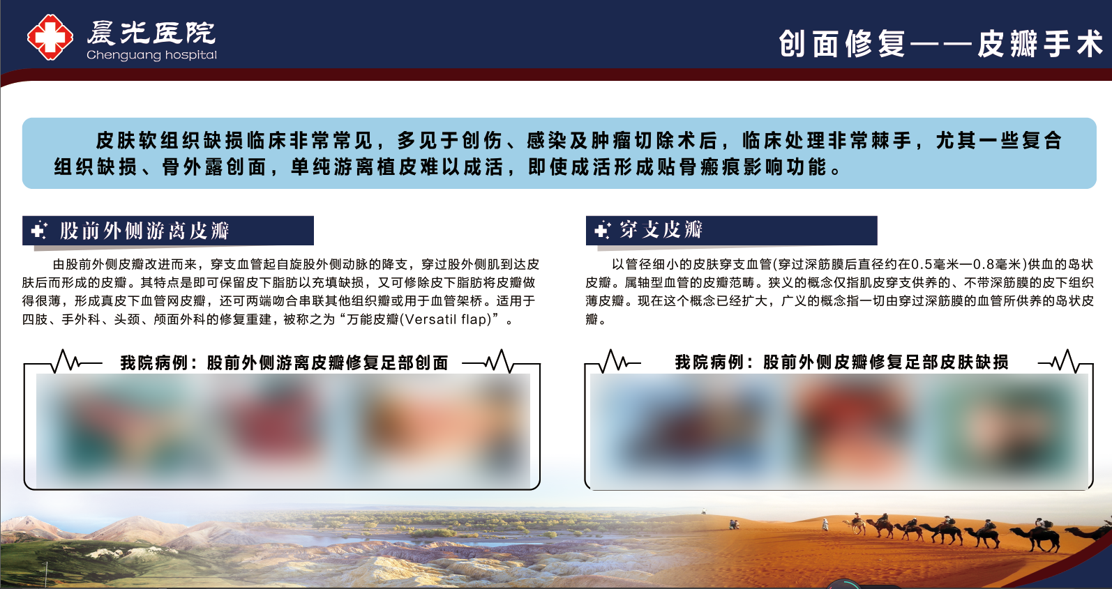 创面修复皮瓣手术 —— 万能皮瓣