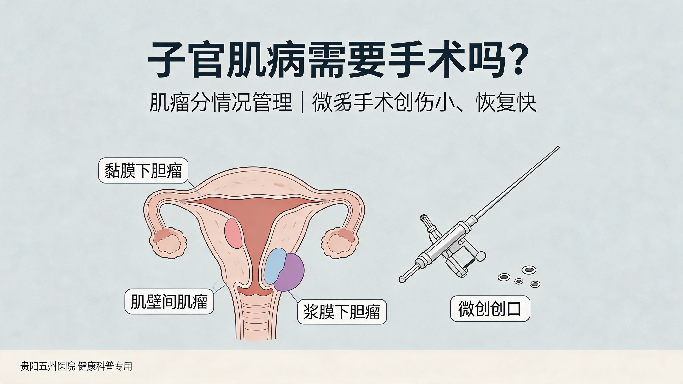 子宫肌瘤需要手术吗？贵阳妇科医师解答常见疑问